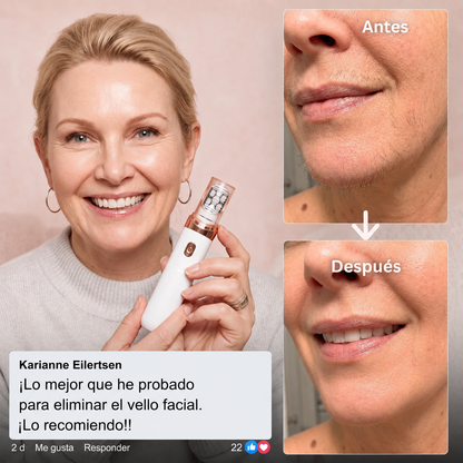 Epimax - Depiladora facial eléctrica rotativa