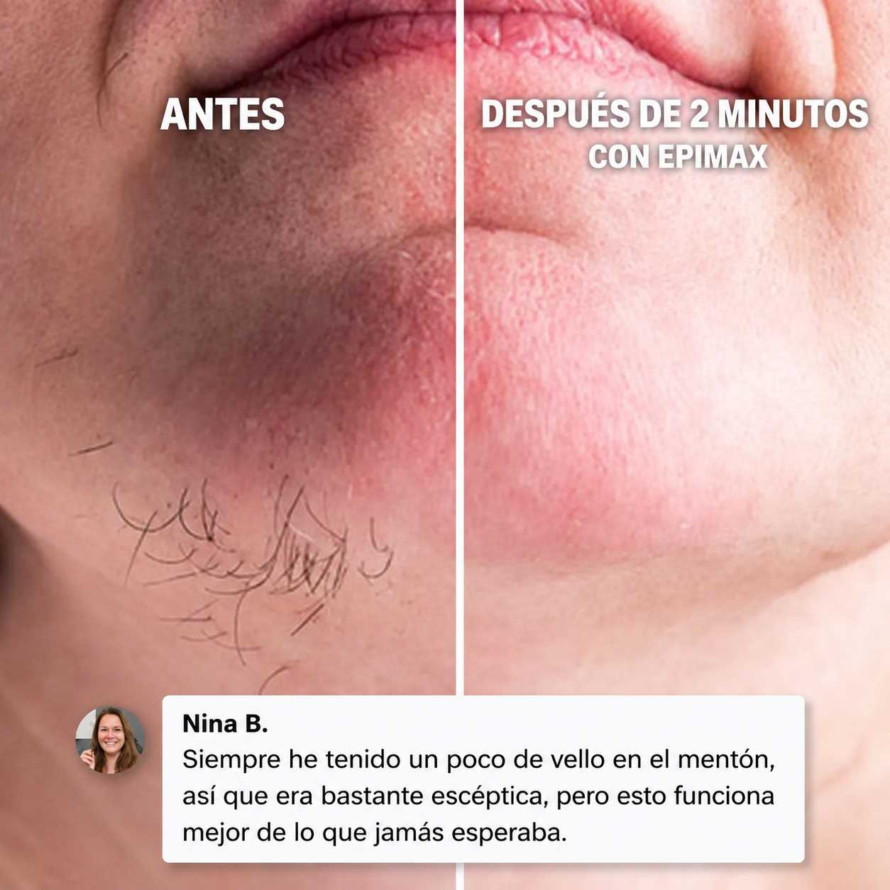 Epimax - Depiladora facial eléctrica rotativa