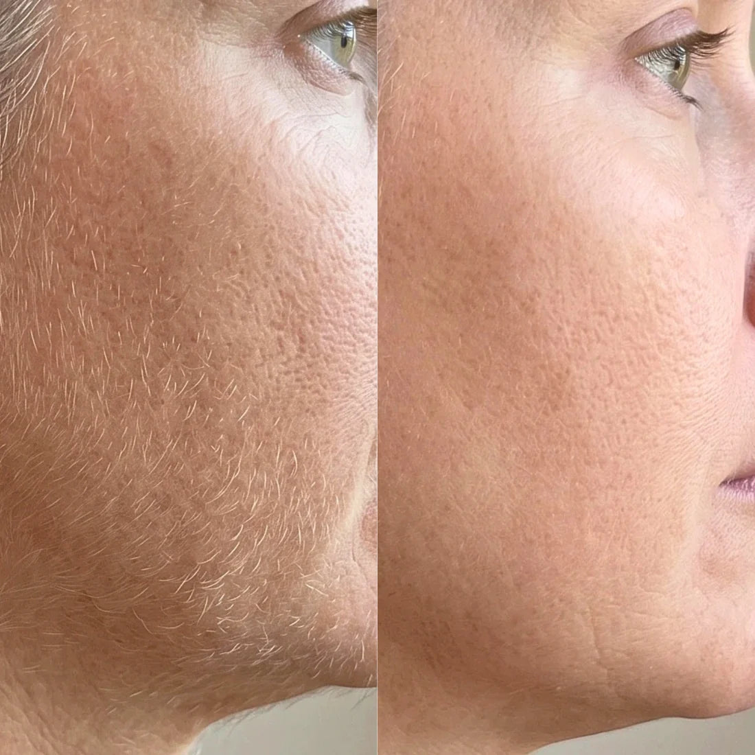 Epimax - Depiladora facial eléctrica rotativa