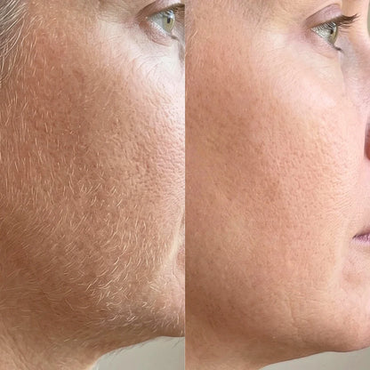 Epimax - Depiladora facial eléctrica rotativa